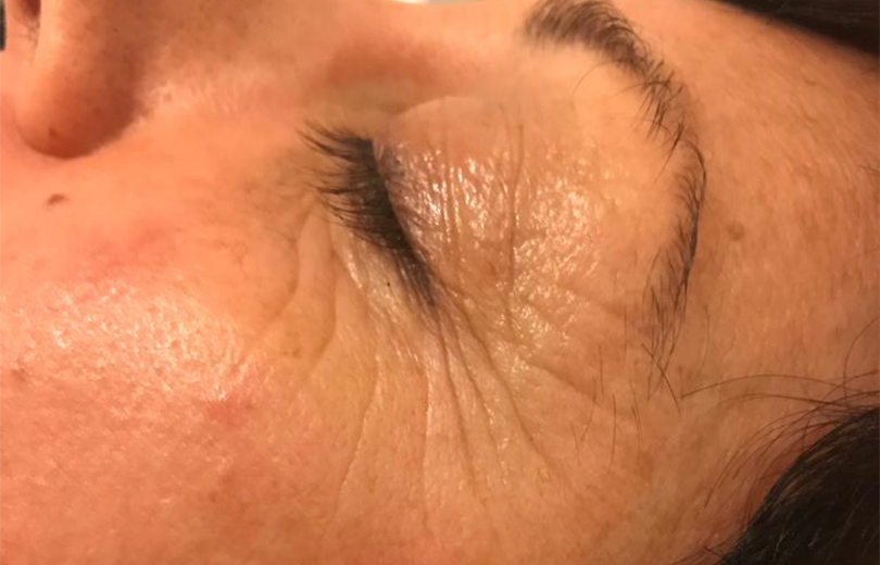 trattramento viso anti aging